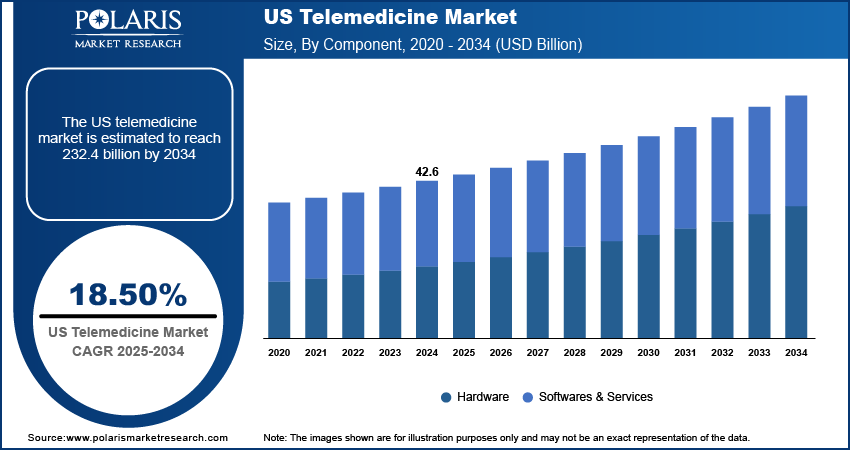 US Telemedicine Market Size, Share | Growth Report 2034