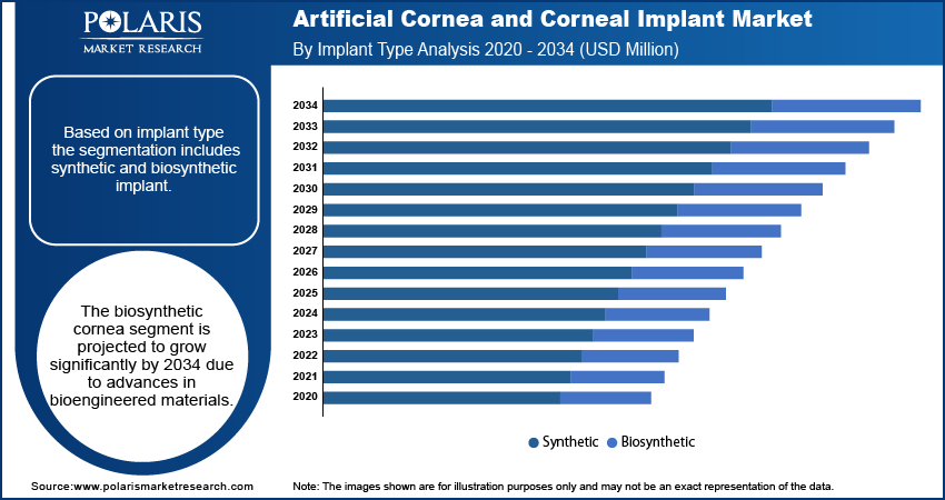 Artificial Cornea and Corneal Implant Market By Implant Type Analysis, 2020 - 2034 (USD Million)