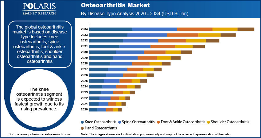 Osteoarthritis Market By Disease Type Analysis 2020 - 2034 (USD Billion)