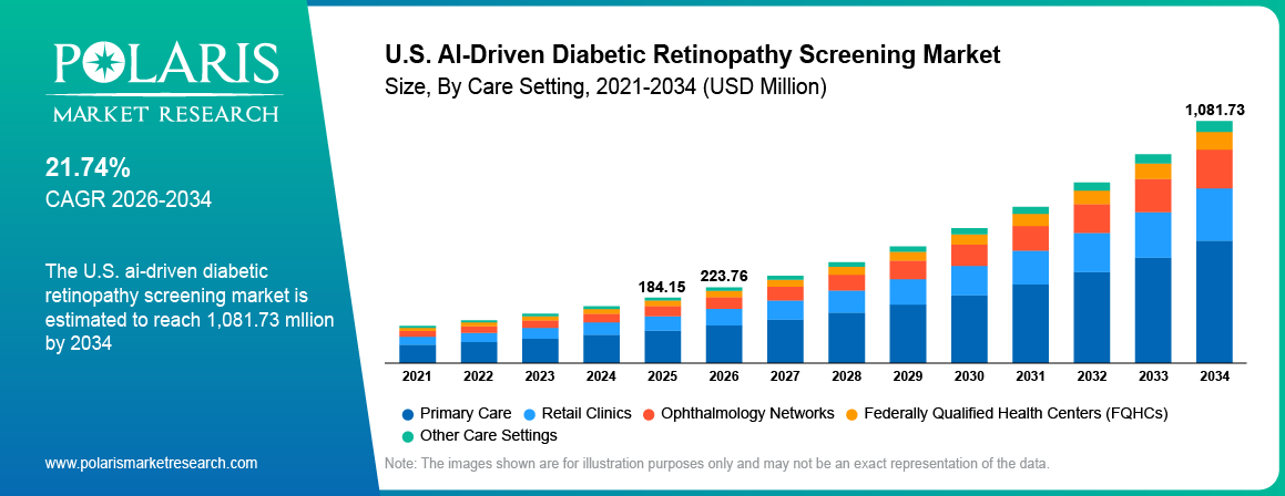 U.S. AI Diabetic Retinopathy Screening Market Size By Region 2021 - 2034