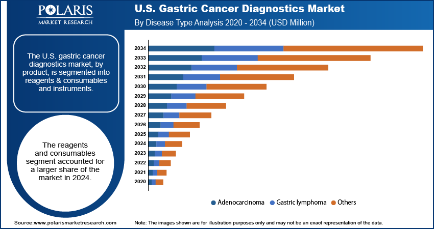 U.S. Gastric Cancer Diagnostics Market By Disease Type Analysis, 2020 - 2034 (USD Million)