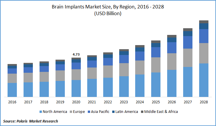 Brain Implants Market Size