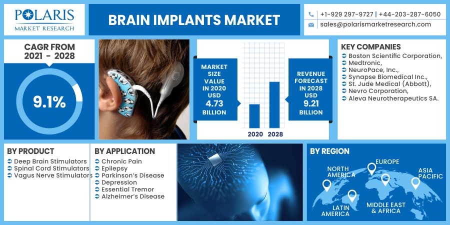 Brain Implants Market