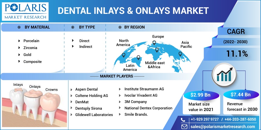 Dental Inlays & Onlays Market